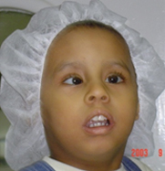 preoperative
